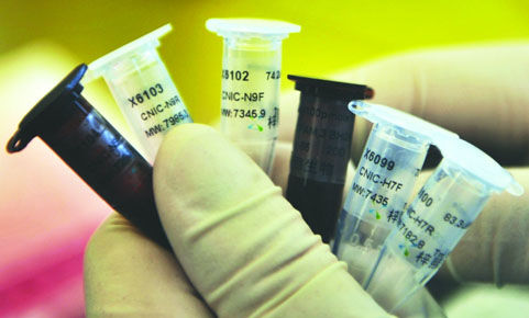 青岛获得首批禽流感检测试剂 市民可免费检测 