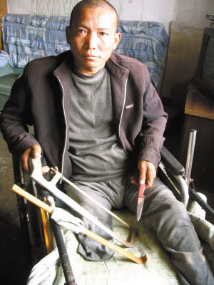 郑艳良就是用这几样简陋工具，给自己做了右腿截肢手术。