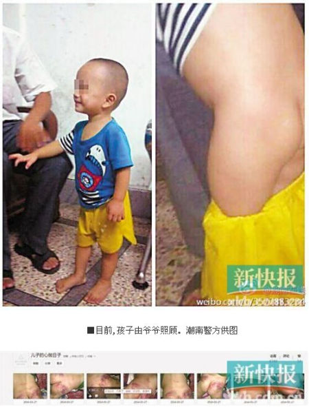 男子因妻子出轨虐待儿子 微博发布多张虐童照片